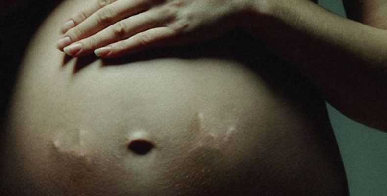 Распространенные осложнения беременности