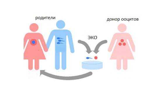 Сохранение детородной функции: заморозка ткани яичника у больных раком девочек и девушек | memorial sloan kettering cancer center