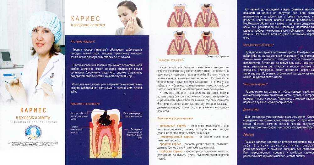 Кариес зубов: симптомы, причины, диагностика и лечение