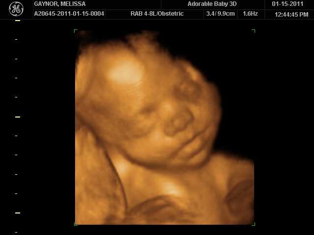 живот на 29 неделе беременности фото, 29 неделя беременности фото животиков, фото беременных на 29 неделе беременности