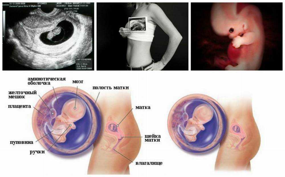 Признаки беременности на ранних сроках - блог медицинского центра "реновацио"