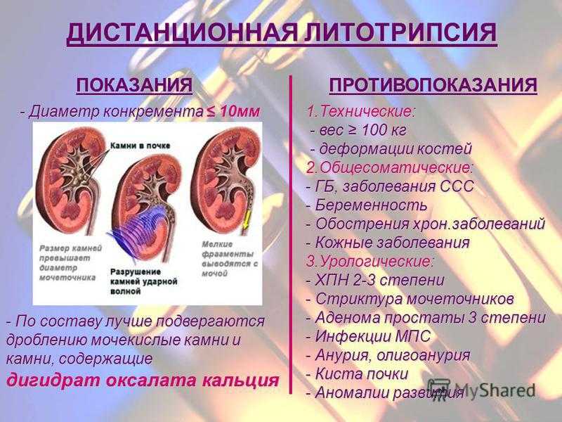 Беременность и инфекции мочевыводящих путей (имвп)