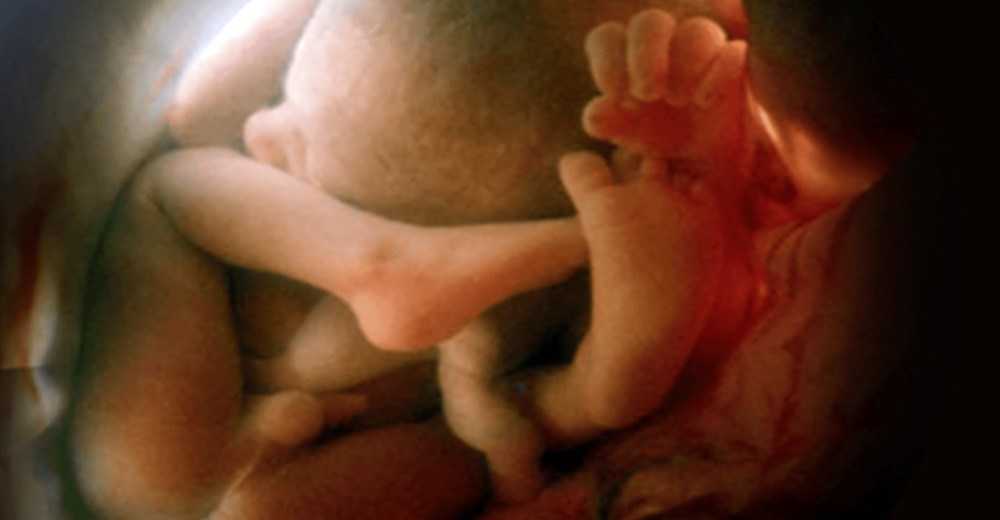 18 неделя беременности - ощущения и фото — евромедклиник