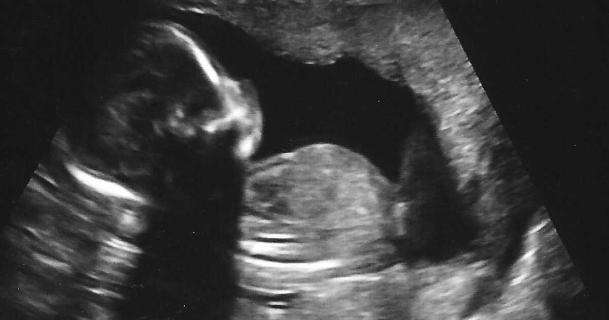 Двенадцатая неделя беременности акушерская: что происходит, фото живота, узи плода, советы специалистов | nutrilak
