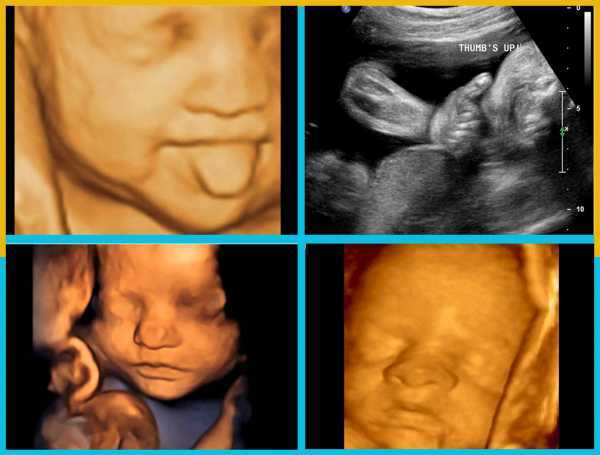 Фото узи ребенка на разных сроках беременности * клиника диана