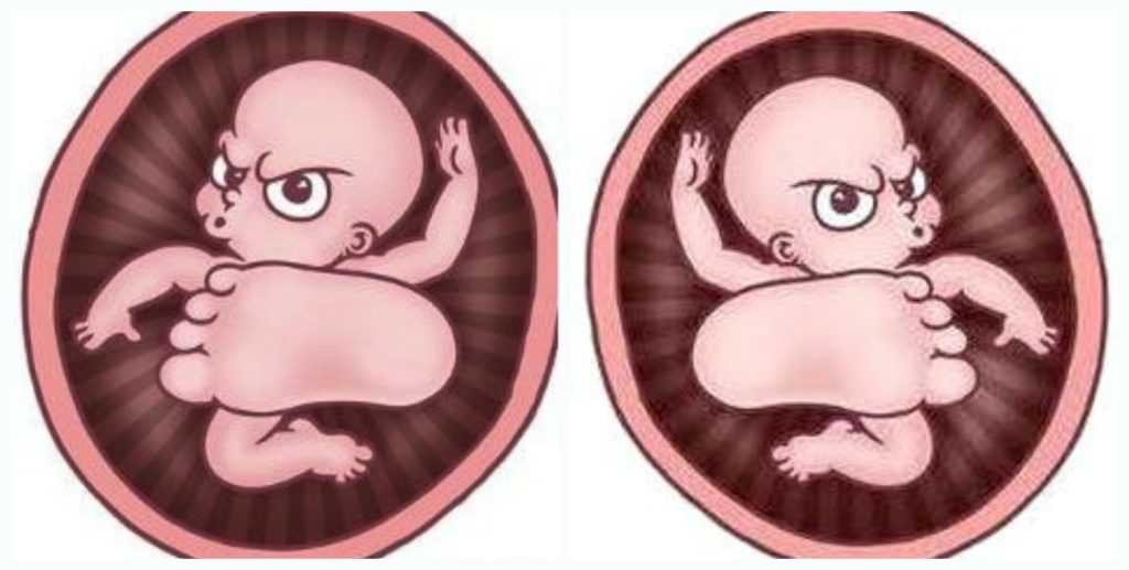 живот на 35 неделе беременности фото, 35 неделя беременности фото животиков, фото беременных на 35 неделе беременности