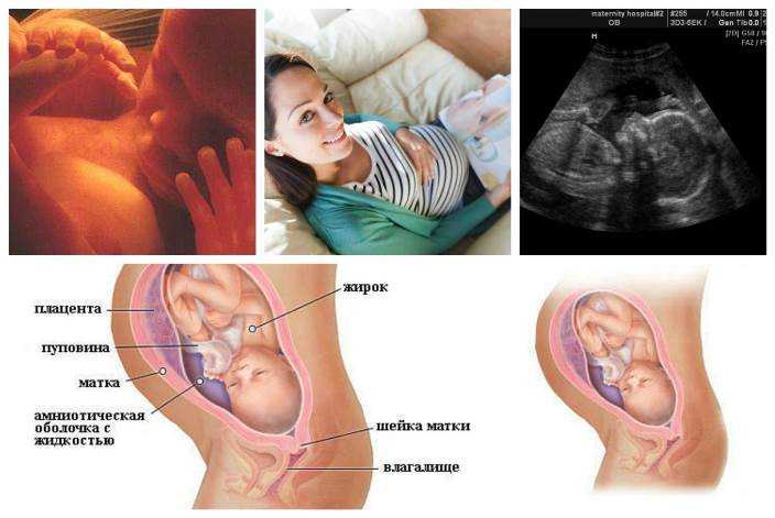 Хгч по неделям беременности – таблица уровней: как растет хгч при беременности