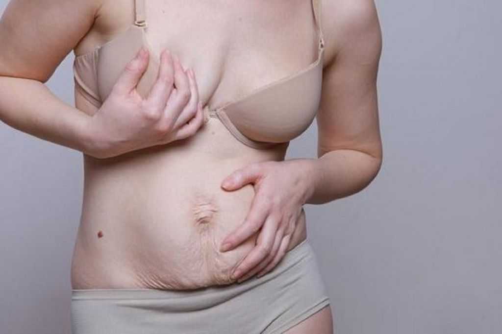 Пластика груди после родов