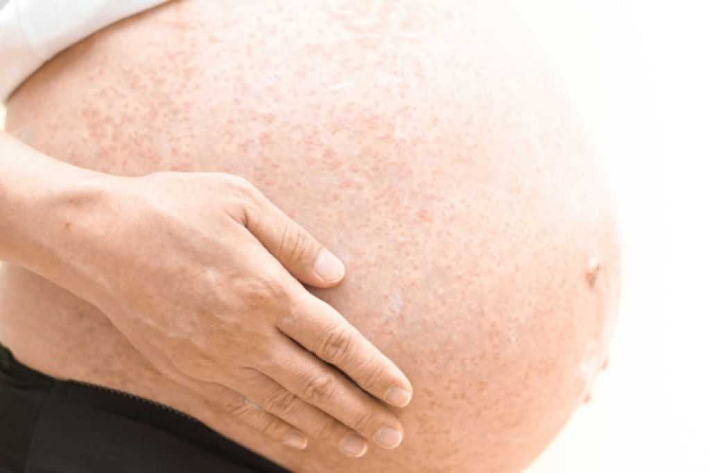 Беременность и коронавирус. что нам известно об этом?