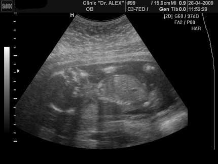 22 неделя беременности фото плода и ощущения — евромедклиник