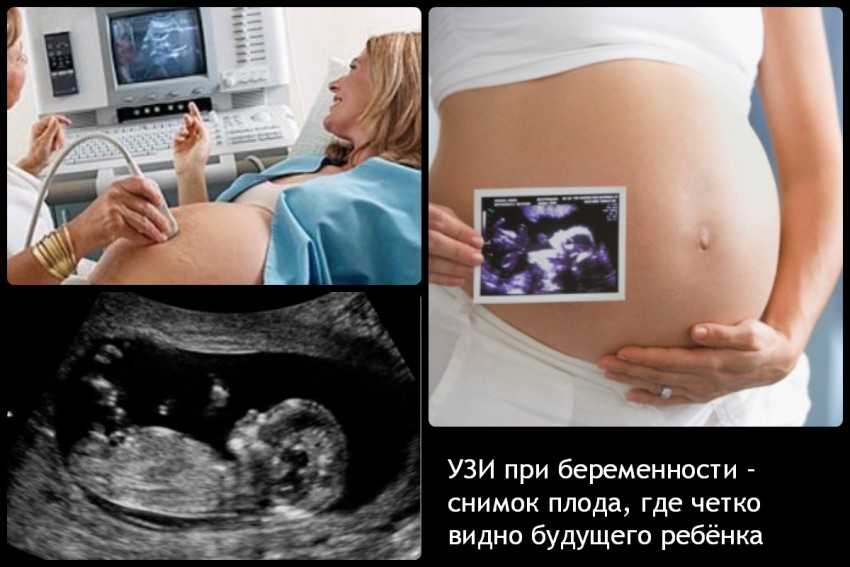 Косметология во время беременности