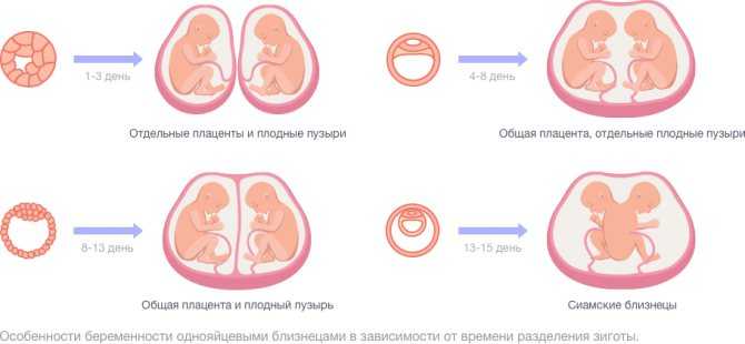 Через сколько поколений рождаются двойняшки (близнецы) - если были в роду, передается ли по наследству, какова вероятность