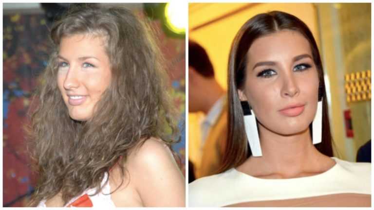 Кэти топурия до и после пластики – как и почему изменилась внешность певицы