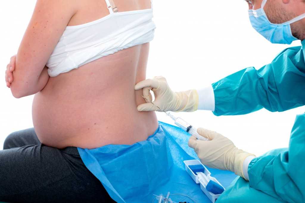 Анестезия при кесаревом сечении и родах — подготовка, осложнения после наркоза