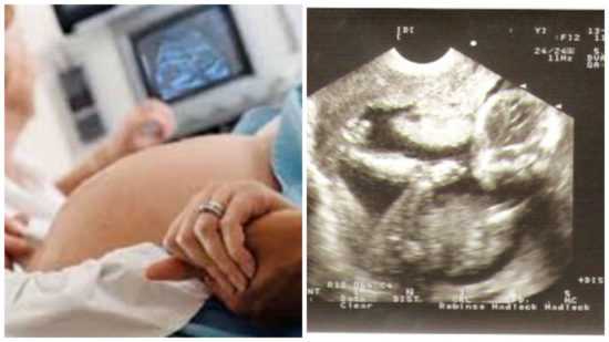 живот на 29 неделе беременности фото, 29 неделя беременности фото животиков, фото беременных на 29 неделе беременности