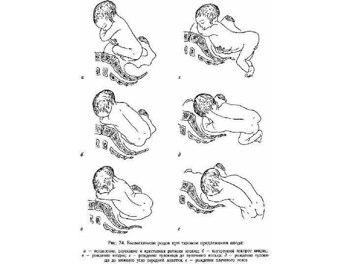 Когда ребенок переворачивается вниз головой в животе во время беременности - журнал expertology