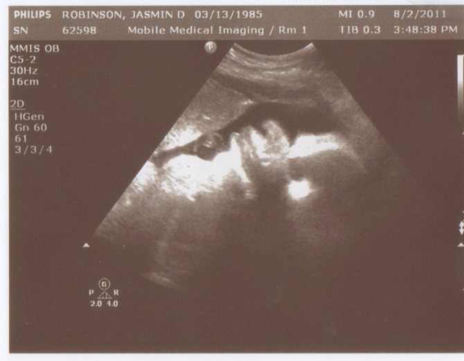 Как выглядит живот на 19 неделе беременности: 12 фото из инстаграма - «беременность»