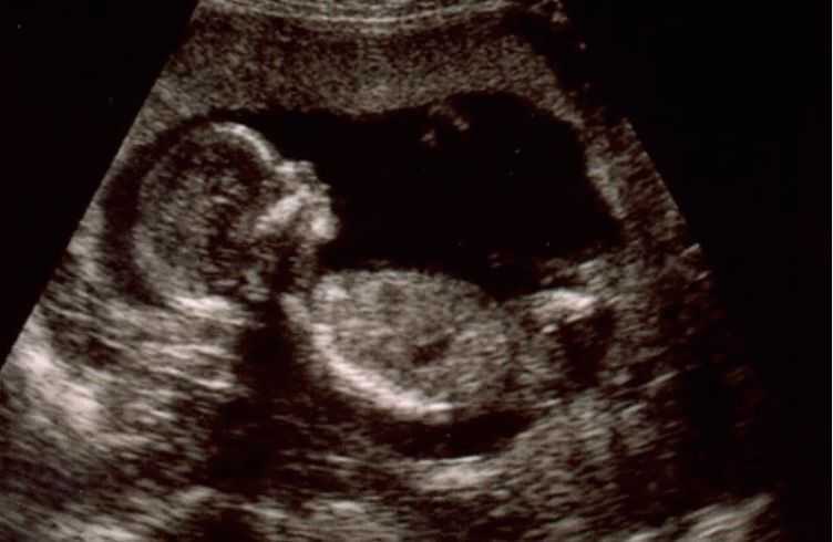 Узи на 26 неделе беременности: интересные факты