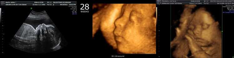 15 неделя беременности  развитие и фото — евромедклиник