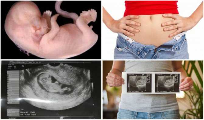 как выглядит живот на 11 неделе беременности, живот +на 11 неделе беременности, 11 недель беременности фото живота, какой живот 11 неделе беременности, 11 неделя беременности живот +не растет, большой живот +на 11 неделе беременности, размер живота +на 11