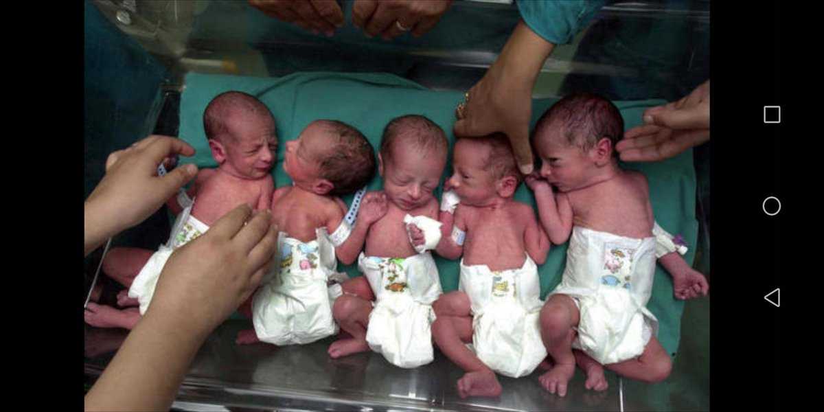 Многоплодие - multiple birth