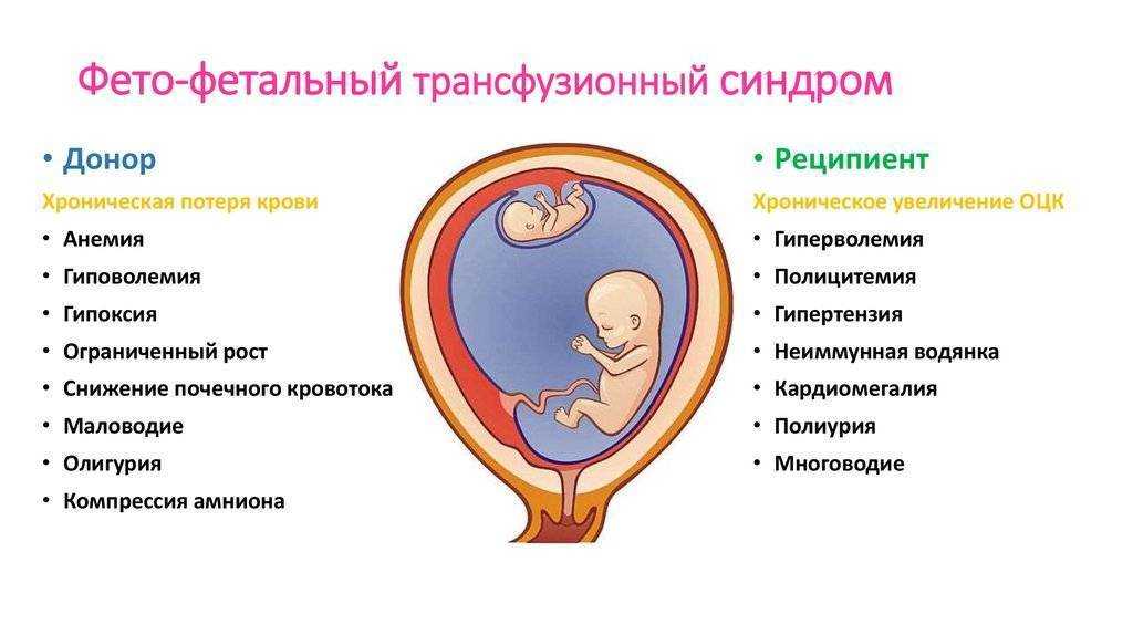 Рождение близнецов – эволюционное преимущество для матерей - hi-news.ru