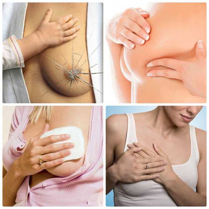 Как восстановить форму груди