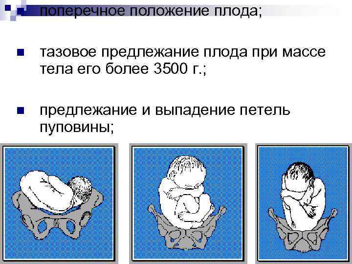 Упражнения чтобы ребенок перевернулся головой вниз при тазовом предлежании: как перевернуть ребенка в головное положение – гимнастика для беременных для переворота плода